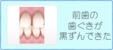 前歯の歯ぐきが黒ずんできた方はこちら